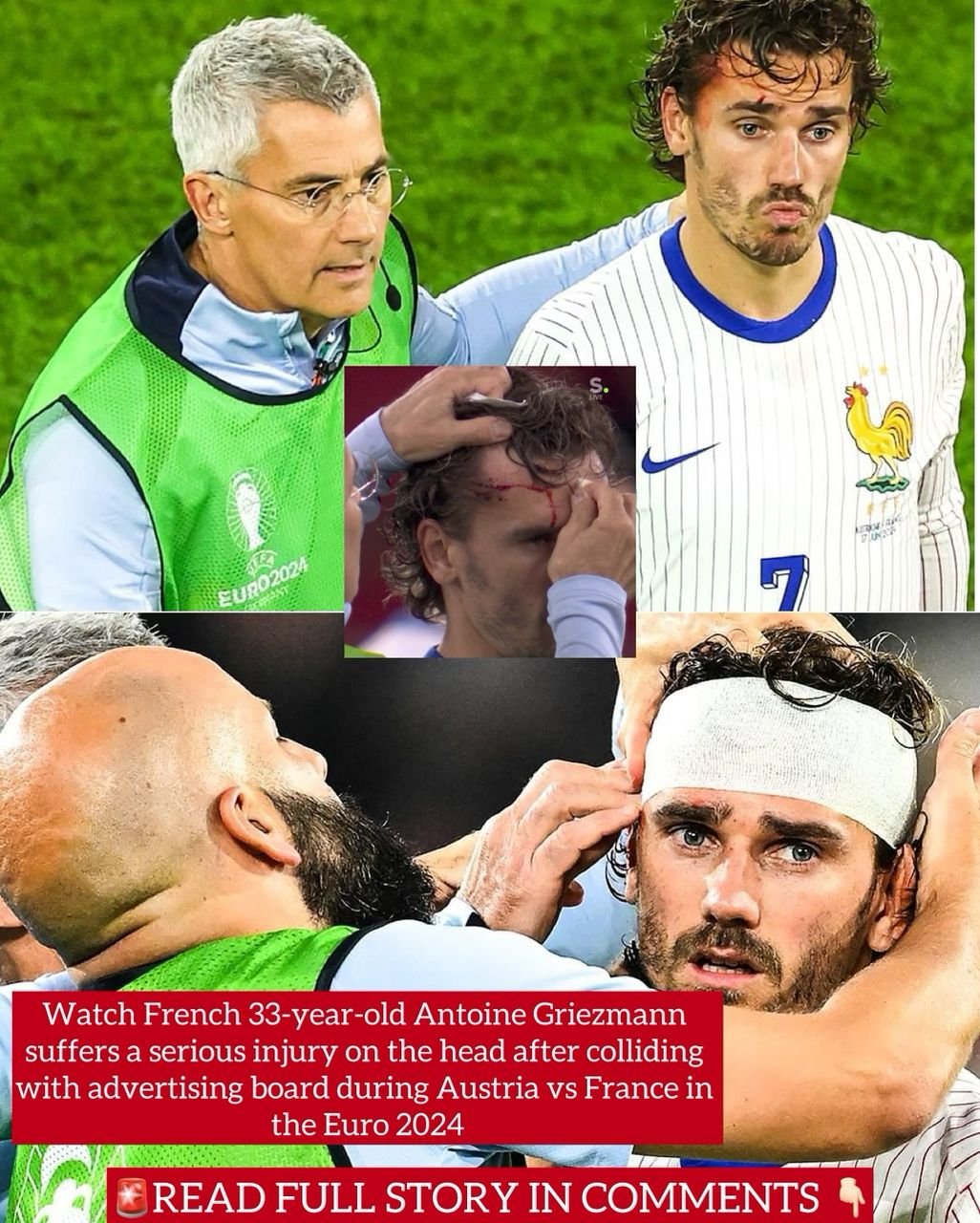 Watch French 33-year-old Antoine Griezmann suffers a serious injury on the head after colliding with advertising board during Austria vs France in the Euro 2024