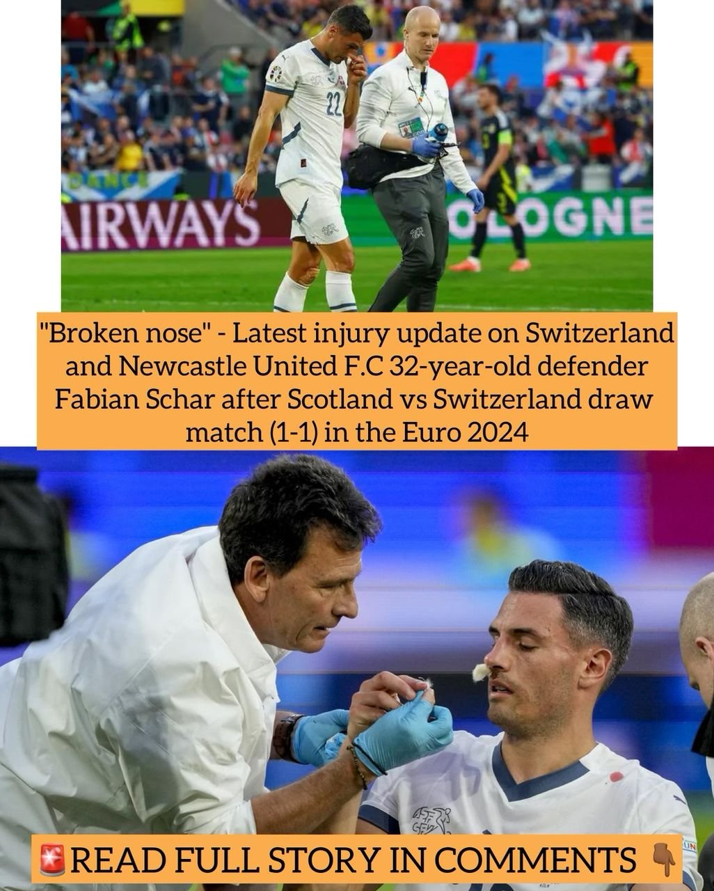 "Broken nose" - Latest injury update on Switzerland and Newcastle United F.C 32-year-old defender Fabian Schar after Scotland vs Switzerland draw match (1-1) in the Euro 2024