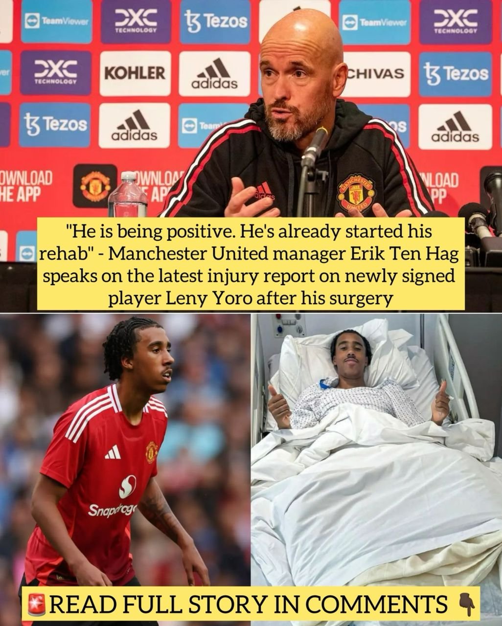 "He is being positive. He's already started his rehab" - Manchester United manager Erik Ten Hag speaks on the latest injury report on newly signed player Leny Yoro after his surgery
