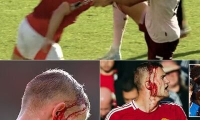 Everything that happened as Manchester United defender Matthijs de Ligt sustained bloody head injury during their Premier League match against Brentford