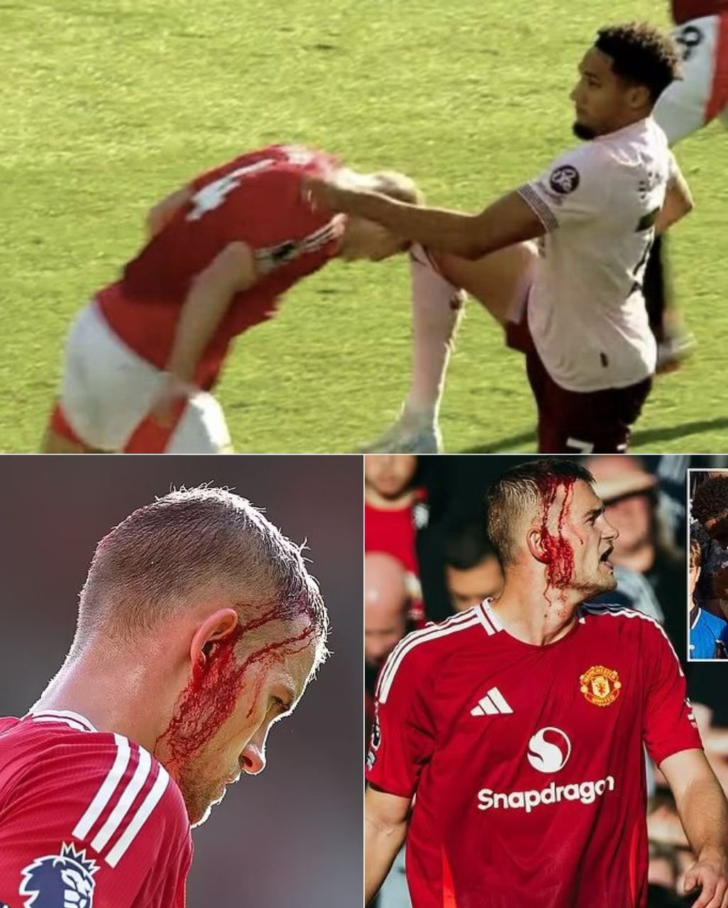 Everything that happened as Manchester United defender Matthijs de Ligt sustained bloody head injury during their Premier League match against Brentford