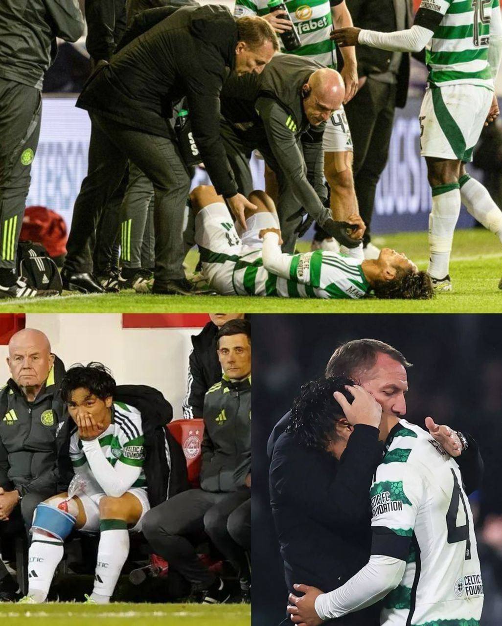 ‘never a good sign’ Celtic reveals Reo Hatate present injury update ahead of the Scottish Cup Final