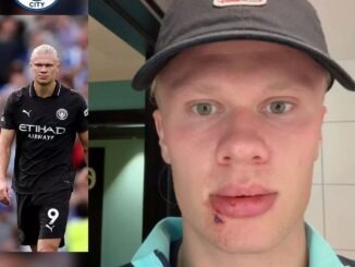 Manchester City striker Erling Haaland reveals the seriousness of his new injury ahead of Manchester derby on sunday